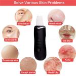 Ultrasonic Facial Scrubber