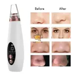6-in-1 Electric Blackhead Remover – Deep Pore Cleanser