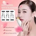 6-in-1 Electric Blackhead Remover – Deep Pore Cleanser